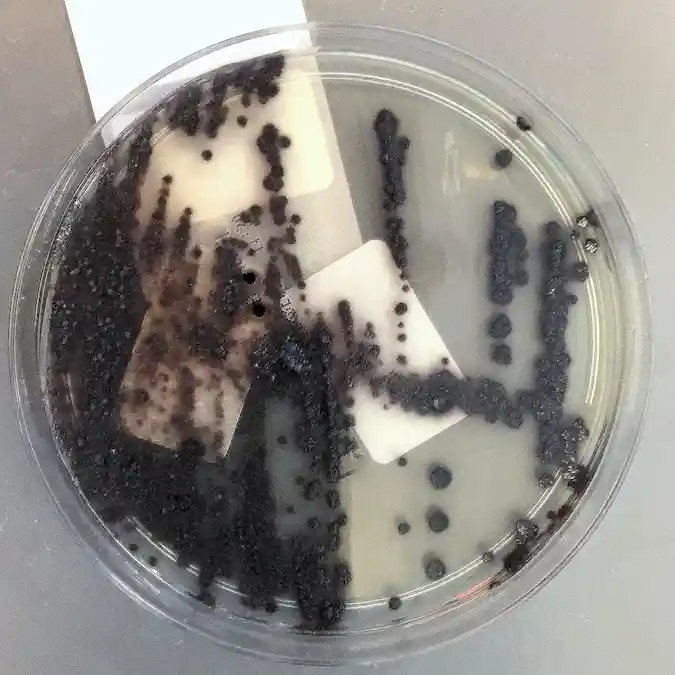 petri dish